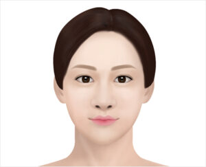 lip asymmetry correction in korea haru clinic
