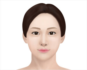 lip asymmetry correction in korea haru clinic