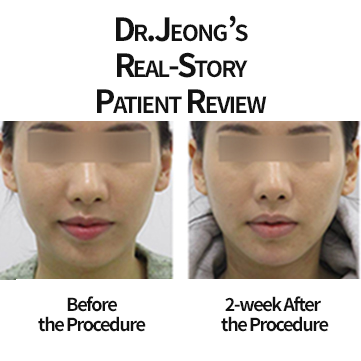 Haru Lip Correction