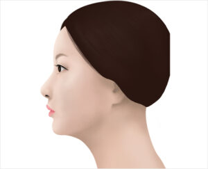 lip asymmetry correction in korea haru clinic