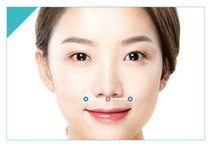 non surgical lip lip in korea Haru Clinic gangnam seoul