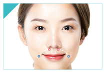non surgical lip lip in korea Haru Clinic gangnam seoul