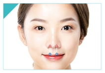 non surgical lip lip in korea Haru Clinic gangnam seoul